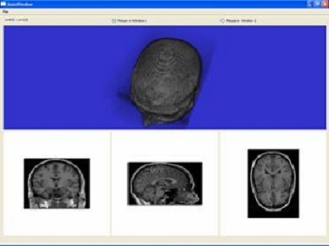 Medical Image Analysis Project