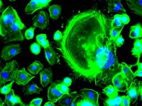 fluorescence microscope results sample #3