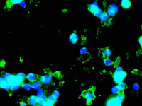 fluorescence microscope results sample #5