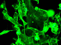 fluorescence microscope results sample #6