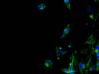 fluorescence microscope results sample #1