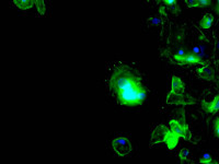 fluorescence microscope results sample #2