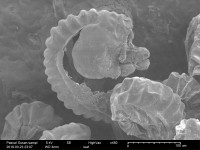 Scanning Electron Microscope sample 5