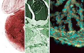 Heart images from Prof. Lafontant's lab